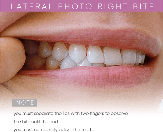 https://mydentalsmile.net/wp-content/uploads/2023/12/2.png