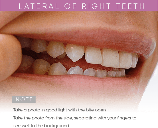 https://mydentalsmile.net/wp-content/uploads/2023/12/3.png