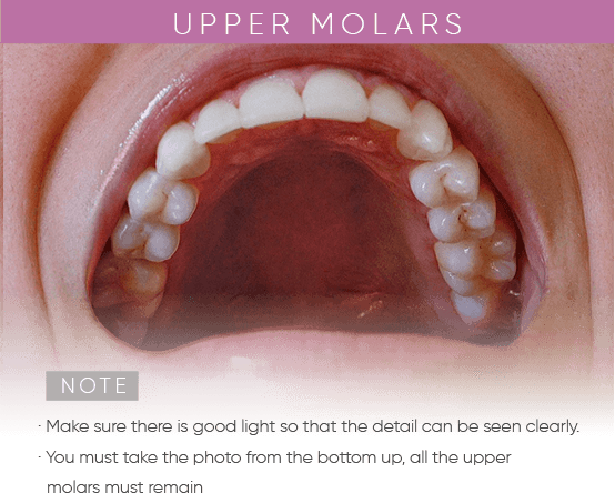 https://mydentalsmile.net/wp-content/uploads/2023/12/4.png