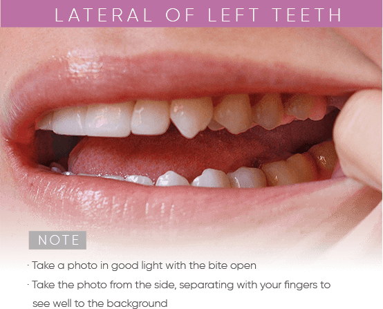 https://mydentalsmile.net/wp-content/uploads/2023/12/6.png