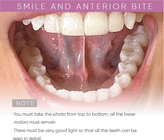 https://mydentalsmile.net/wp-content/uploads/2023/12/7.png